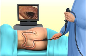 Why Your Doctor Recommends A Colonoscopy Test? Everything You Should Know